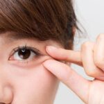 Exploring The Considerations For Double Eyelid Surgery