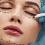 Enhancing Your Gaze: The Art and Science Behind Double Eyelid Procedures