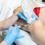 How Doctors Prepare Patients Before Stem Cell Therapy